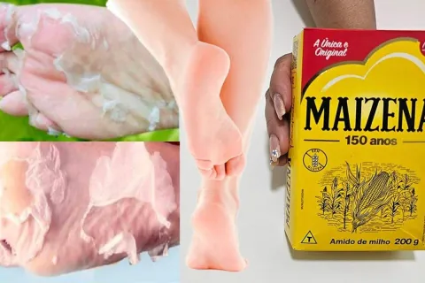 Como tirar rachadura dos pés: solução caseira que funciona p