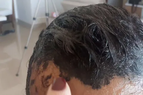 Como tirar tinta de cabelo da pele: técnica fácil e incrível