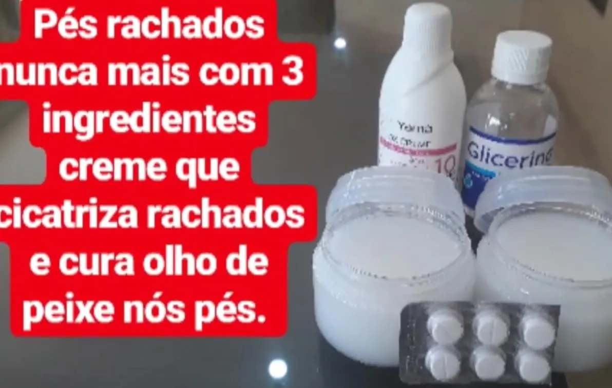 Creme para rachaduras dos pés: faça o creme com 3 ingredient