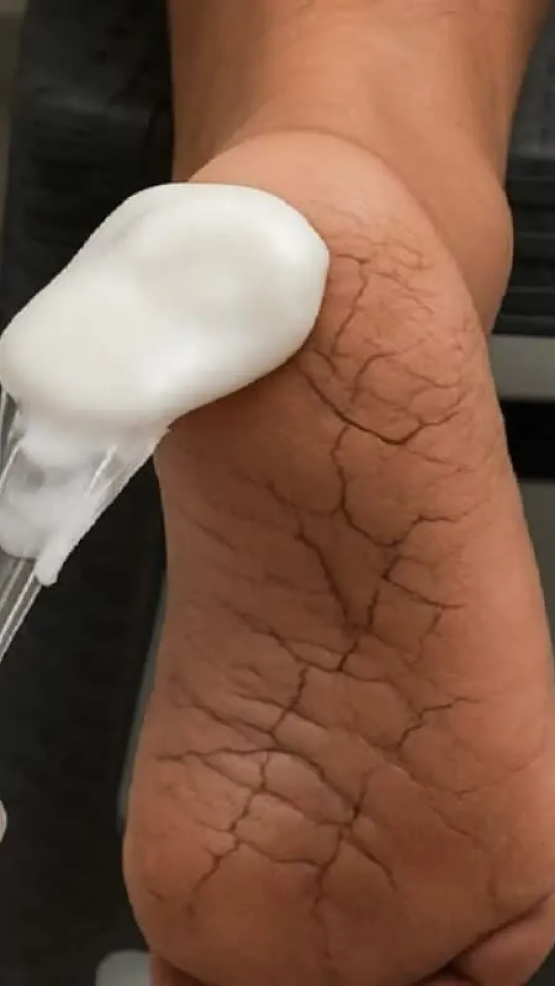 Creme caseiro para rachaduras dos pés que deixa teus pés lisos novamente em pouco tempo
